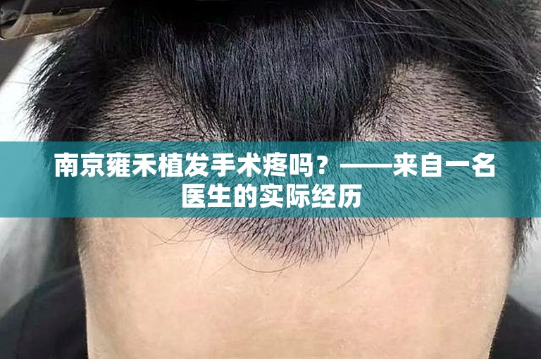  南京雍禾植发手术疼吗？——来自一名医生的实际经历