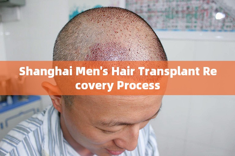 Shanghai Men's Hair Transplant Recovery Process