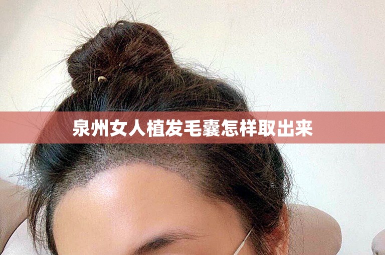 泉州女人植发毛囊怎样取出来