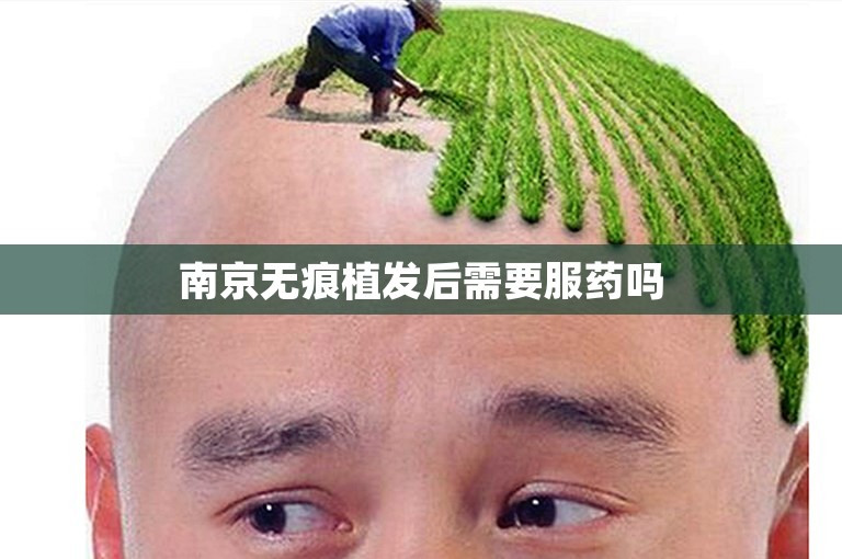 南京无痕植发后需要服药吗