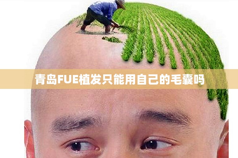 青岛FUE植发只能用自己的毛囊吗