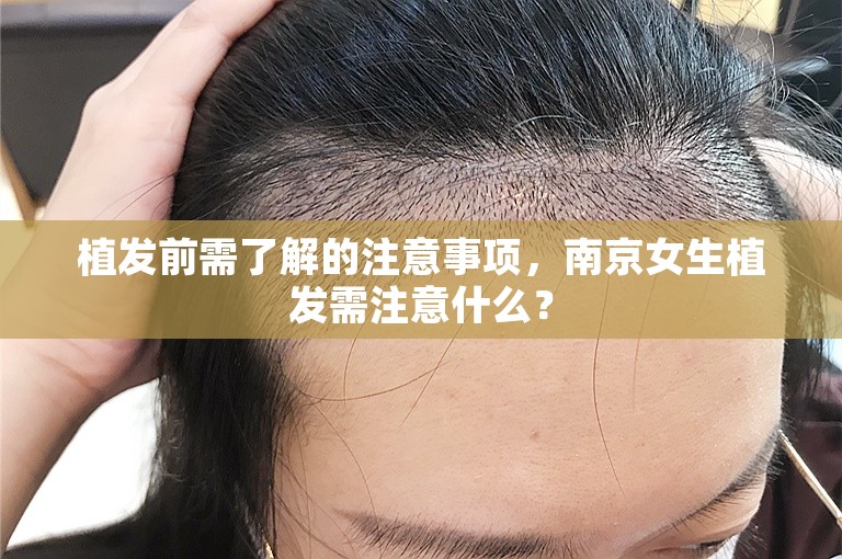 植发前需了解的注意事项，南京女生植发需注意什么？