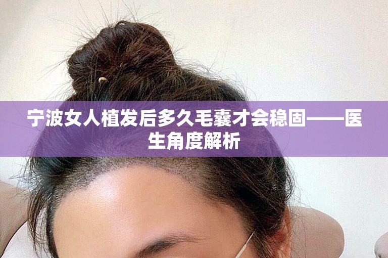 宁波女人植发后多久毛囊才会稳固——医生角度解析