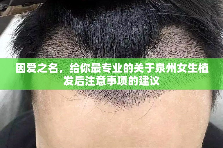 因爱之名，给你最专业的关于泉州女生植发后注意事项的建议