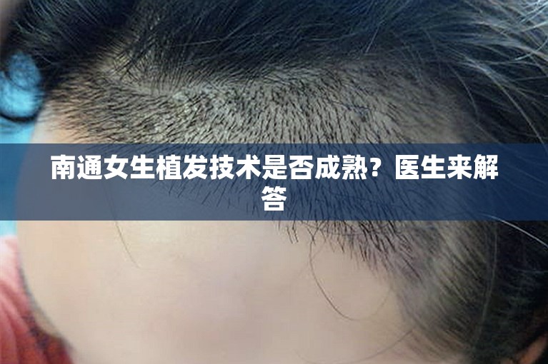 南通女生植发技术是否成熟？医生来解答