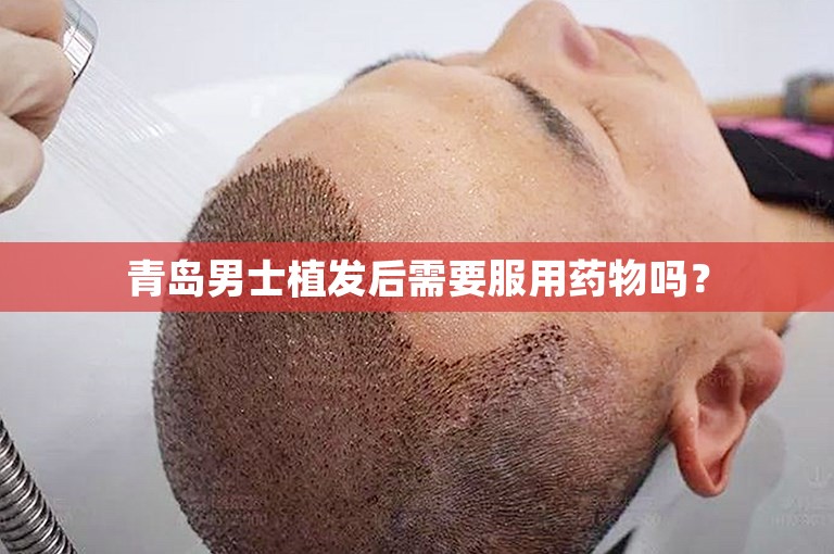 青岛男士植发后需要服用药物吗？