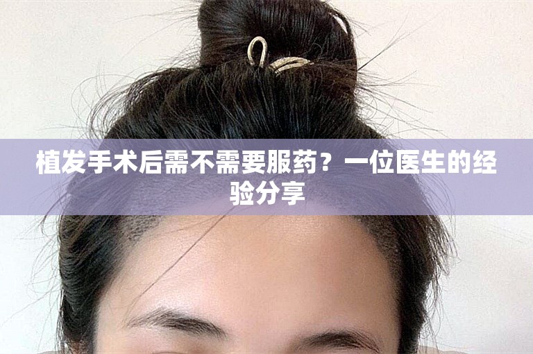 植发手术后需不需要服药？一位医生的经验分享