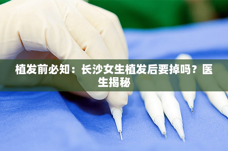 植发前必知：长沙女生植发后要掉吗？医生揭秘