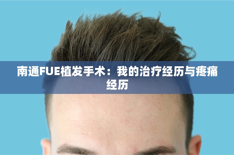 南通FUE植发手术：我的治疗经历与疼痛经历