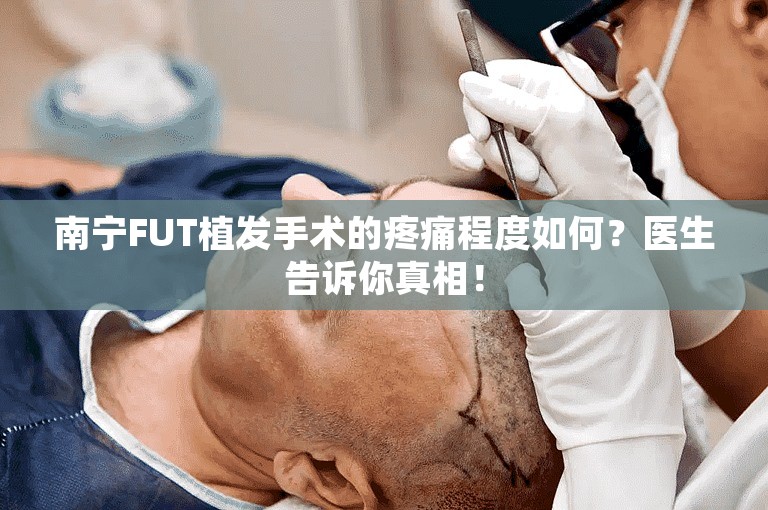 南宁FUT植发手术的疼痛程度如何？医生告诉你真相！