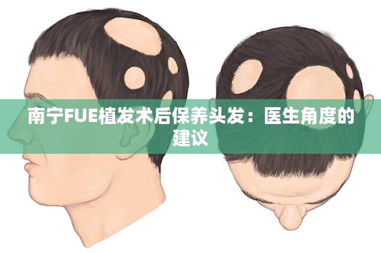 南宁FUE植发术后保养头发：医生角度的建议