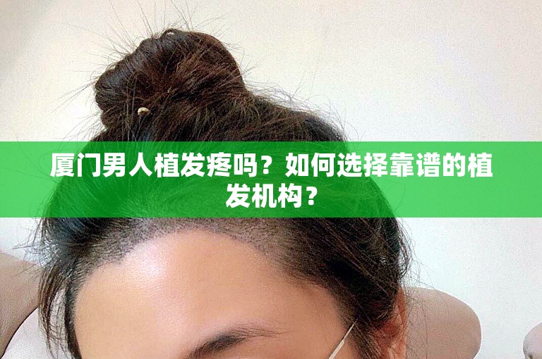 厦门男人植发疼吗？如何选择靠谱的植发机构？