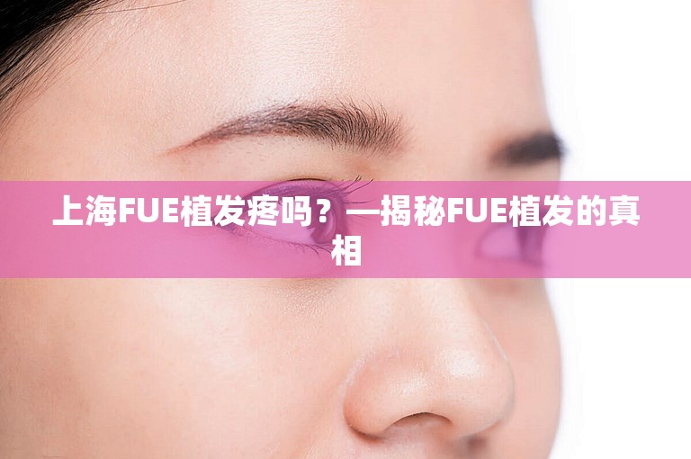 上海FUE植发疼吗？—揭秘FUE植发的真相