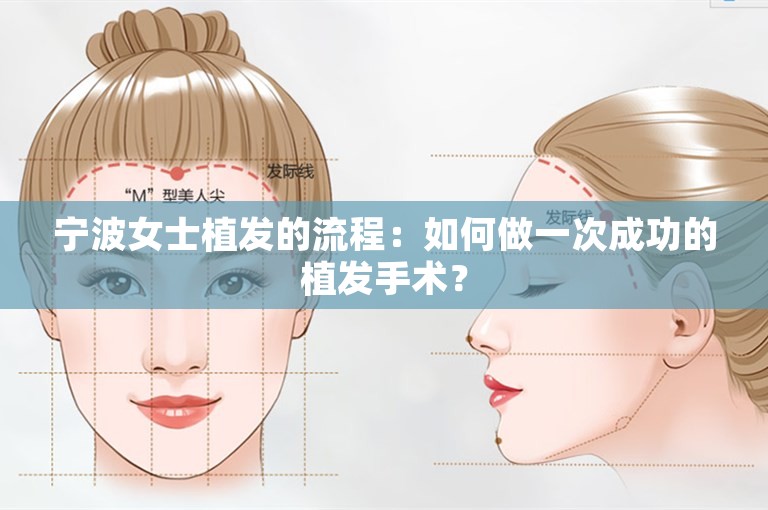 宁波女士植发的流程：如何做一次成功的植发手术？