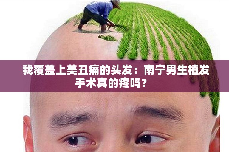  我覆盖上美丑痛的头发：南宁男生植发手术真的疼吗？ 