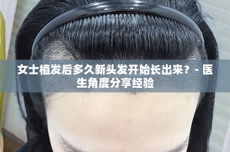 女士植发后多久新头发开始长出来？- 医生角度分享经验