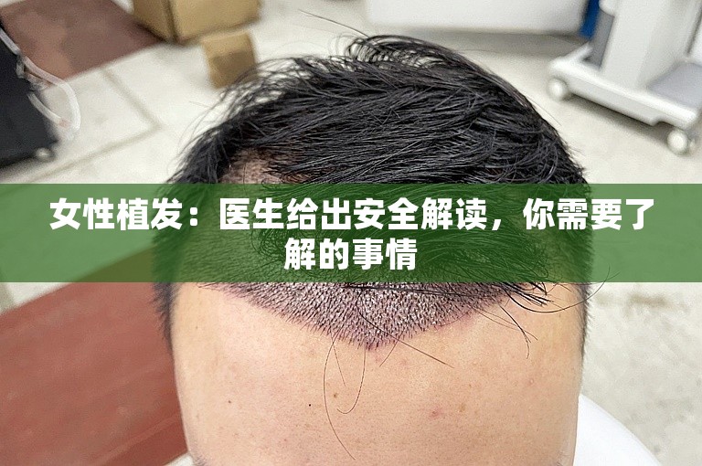 女性植发：医生给出安全解读，你需要了解的事情