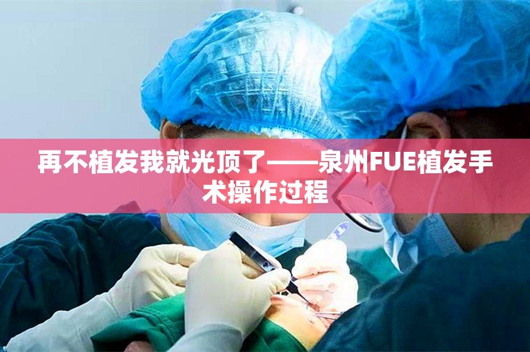 再不植发我就光顶了——泉州FUE植发手术操作过程