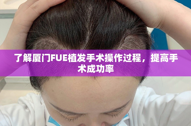 了解厦门FUE植发手术操作过程，提高手术成功率