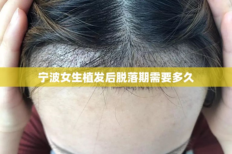  宁波女生植发后脱落期需要多久 