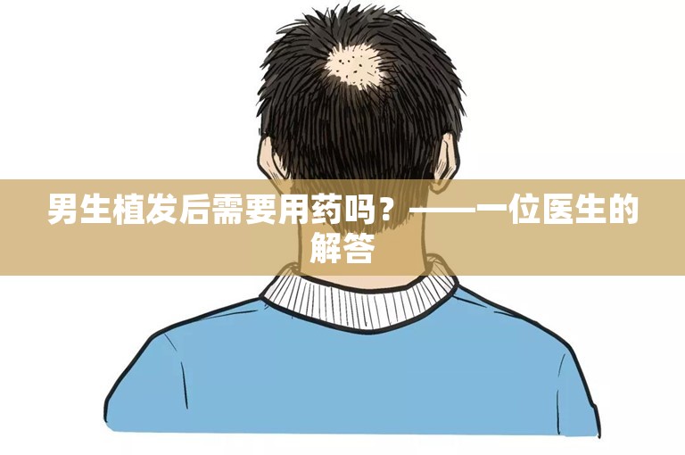 男生植发后需要用药吗？——一位医生的解答