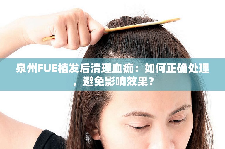 泉州FUE植发后清理血痂：如何正确处理，避免影响效果？