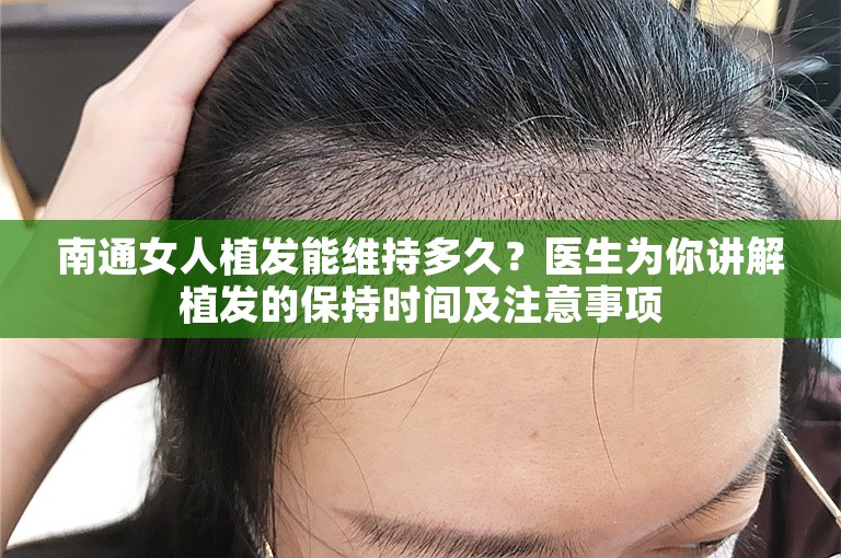 南通女人植发能维持多久？医生为你讲解植发的保持时间及注意事项