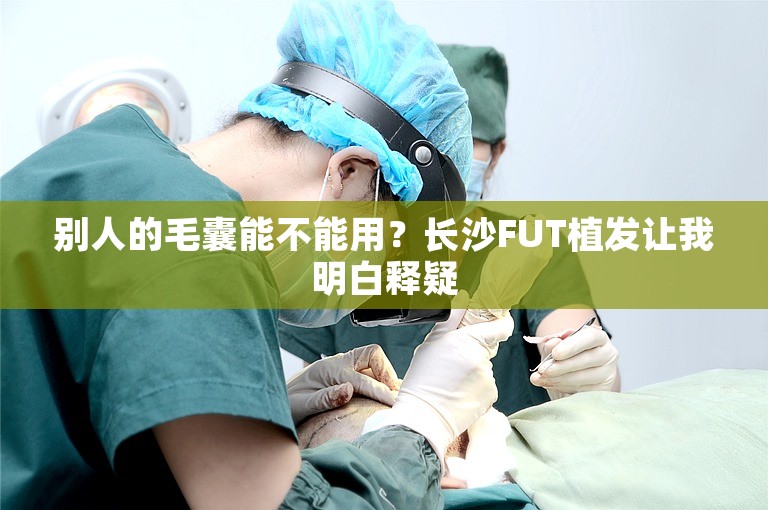 别人的毛囊能不能用？长沙FUT植发让我明白释疑