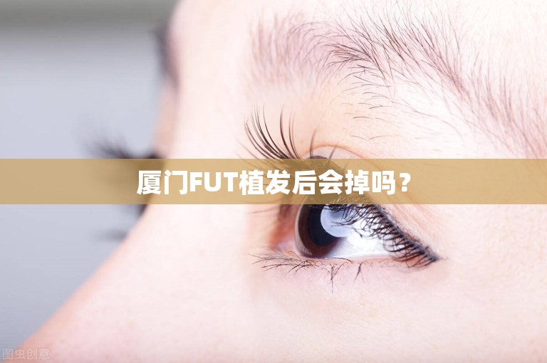 厦门FUT植发后会掉吗？