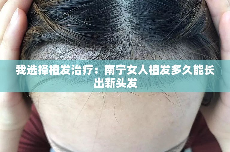 我选择植发治疗：南宁女人植发多久能长出新头发