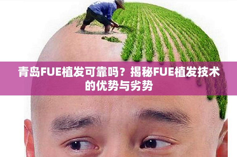 青岛FUE植发可靠吗？揭秘FUE植发技术的优势与劣势