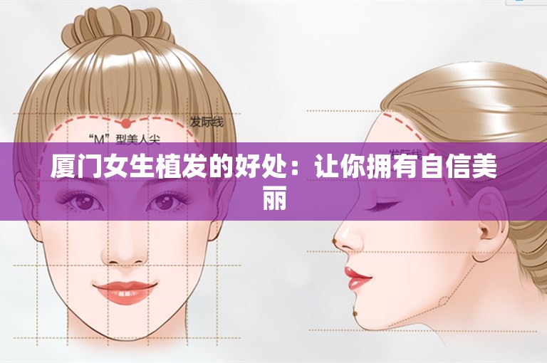 厦门女生植发的好处：让你拥有自信美丽