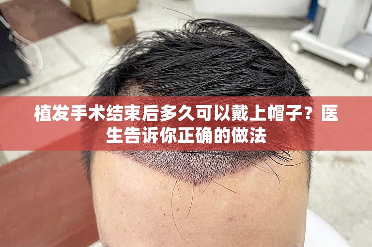 植发手术结束后多久可以戴上帽子？医生告诉你正确的做法