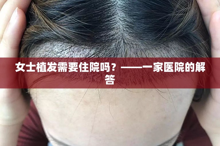 女士植发需要住院吗？——一家医院的解答