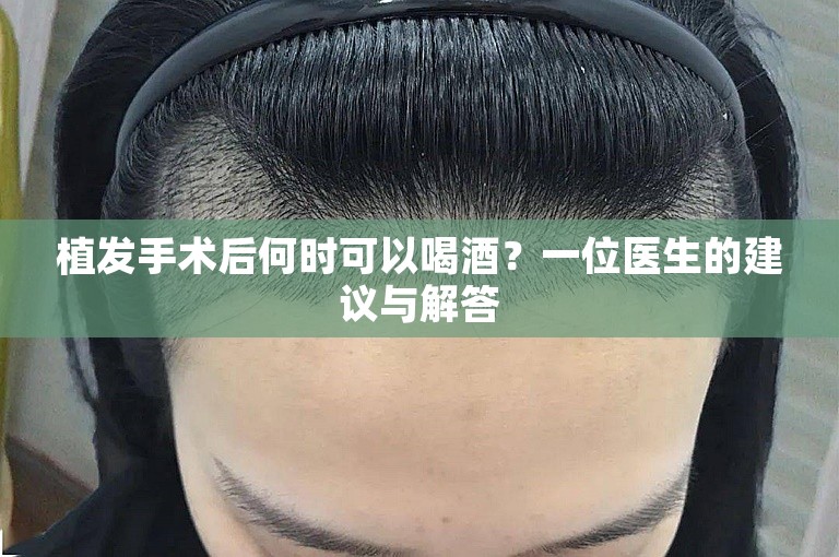 植发手术后何时可以喝酒？一位医生的建议与解答