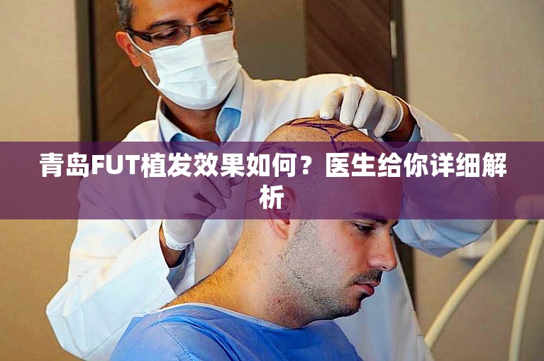 青岛FUT植发效果如何？医生给你详细解析