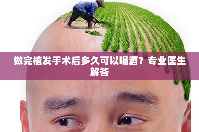 做完植发手术后多久可以喝酒？专业医生解答