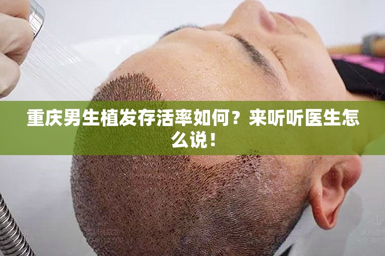 重庆男生植发存活率如何？来听听医生怎么说！