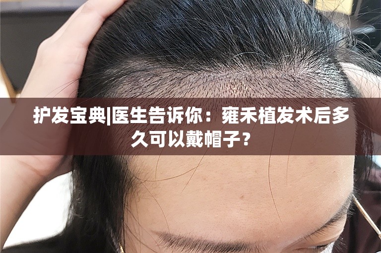 护发宝典|医生告诉你：雍禾植发术后多久可以戴帽子？