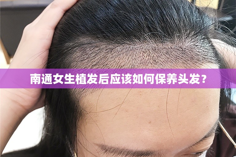 南通女生植发后应该如何保养头发？