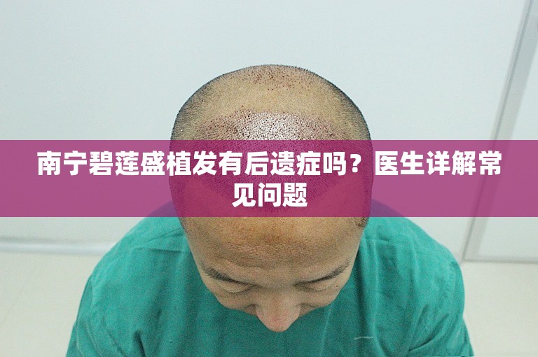 南宁碧莲盛植发有后遗症吗？医生详解常见问题