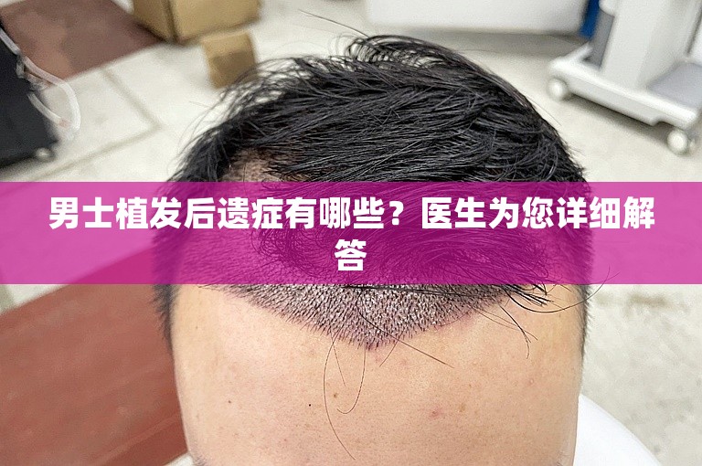 男士植发后遗症有哪些？医生为您详细解答