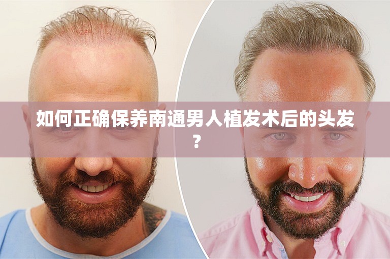 如何正确保养南通男人植发术后的头发？