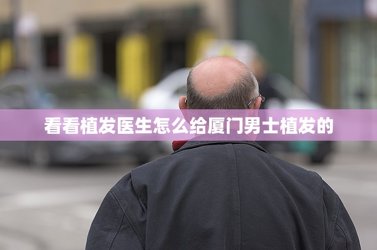 看看植发医生怎么给厦门男士植发的