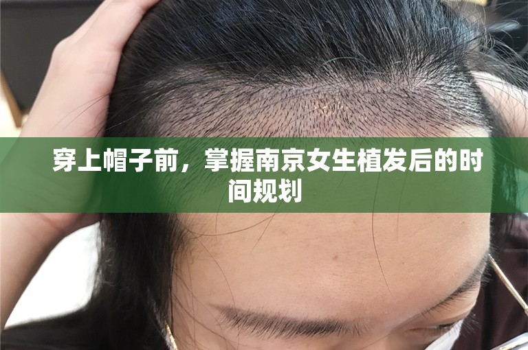  穿上帽子前，掌握南京女生植发后的时间规划