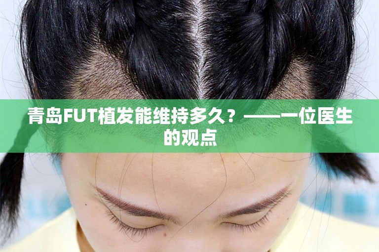 青岛FUT植发能维持多久？——一位医生的观点