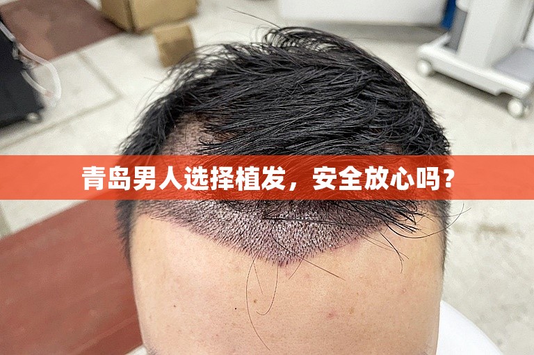 青岛男人选择植发，安全放心吗？