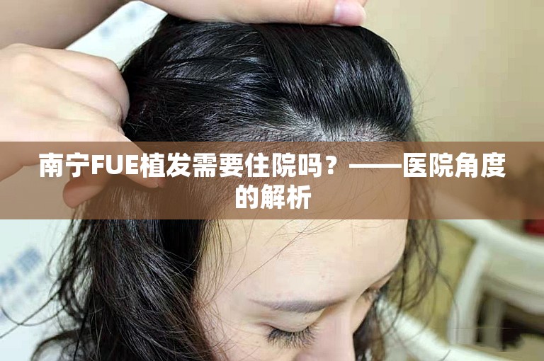 南宁FUE植发需要住院吗？——医院角度的解析