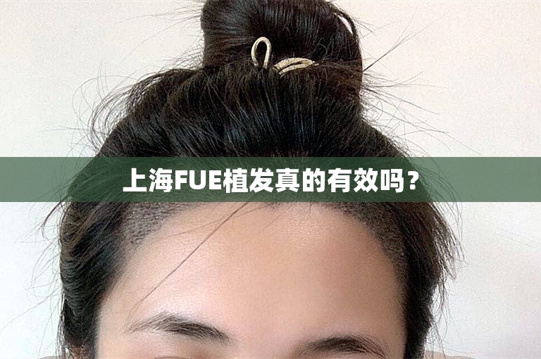 上海FUE植发真的有效吗？