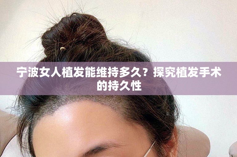 宁波女人植发能维持多久？探究植发手术的持久性